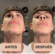 Comparación del proveedor con banda nasal